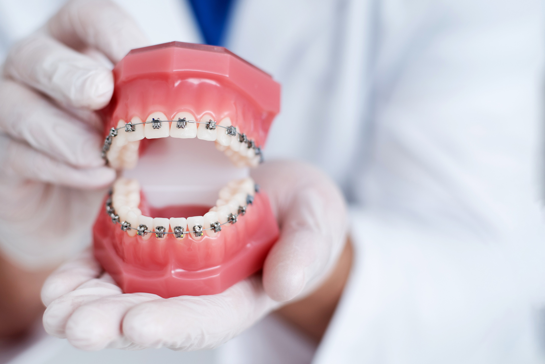 doctor orthodontist shows how the system of braces on teeth is arranged Orthodontist discussing the dental blog with tips and oral health advise in New York NY