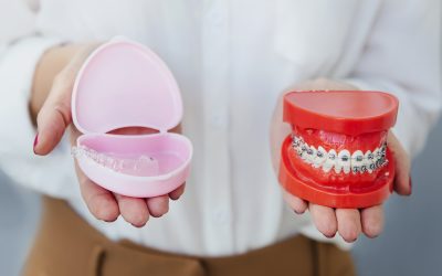 Invisalign Aligners vs. Traditional Braces: Which Option Is Better for You?
